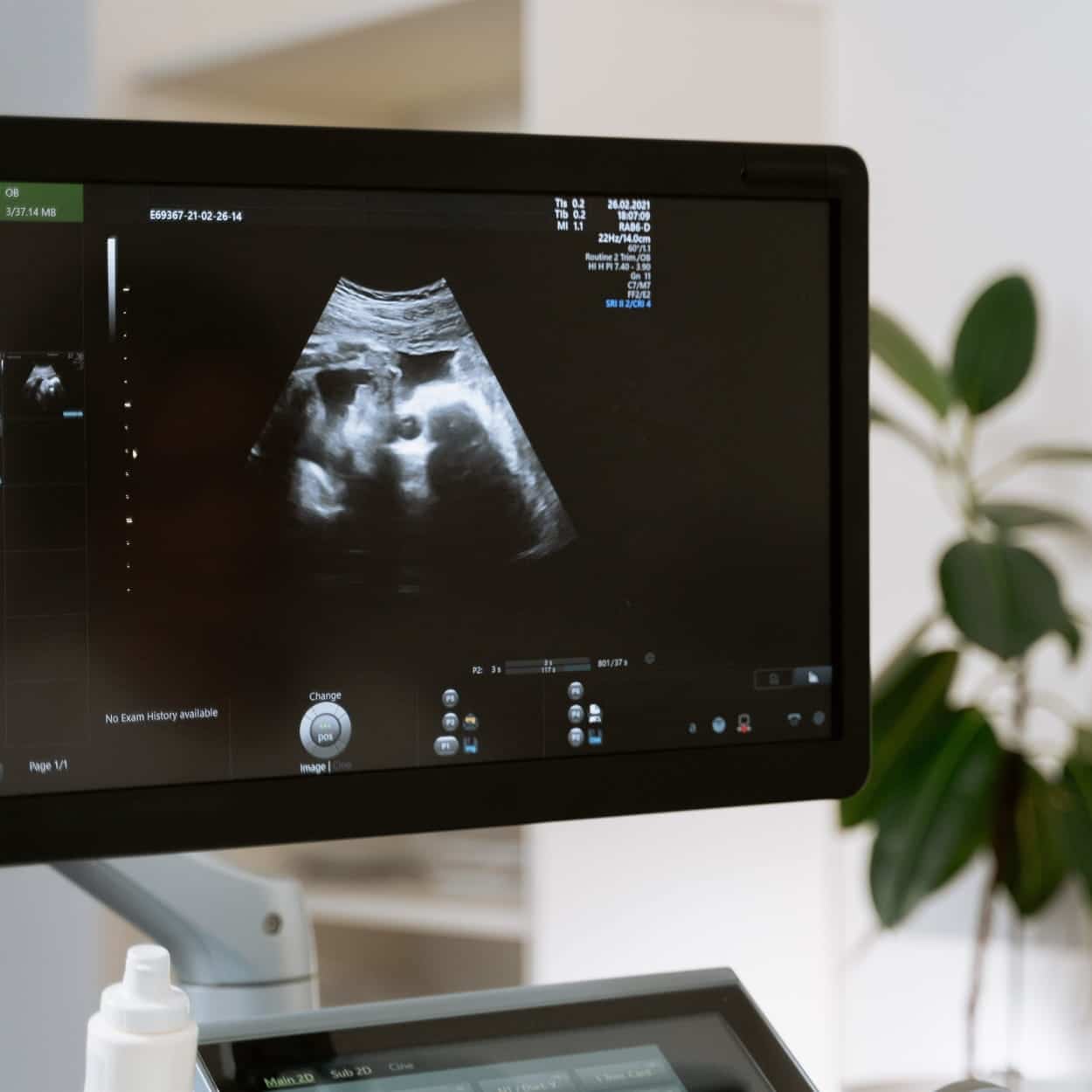 Échographie de grossesse réalisée à Espace Ekhô, Aubagne